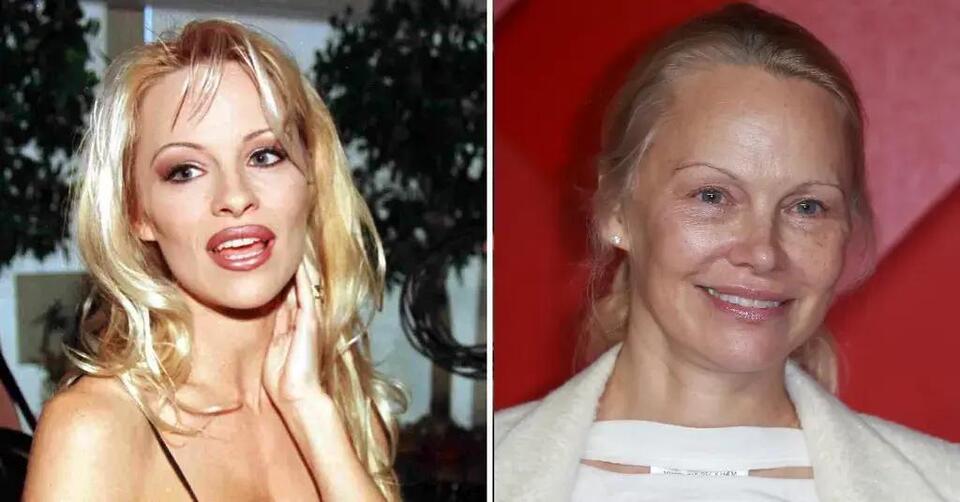 Pamela Anderson Lays Bare Her Exploitation Over Sex Tape How She S