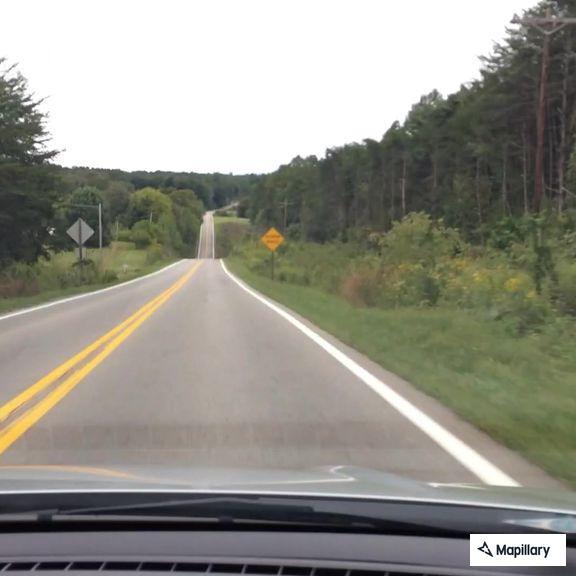 Person with dislocated hips at West Breton Road