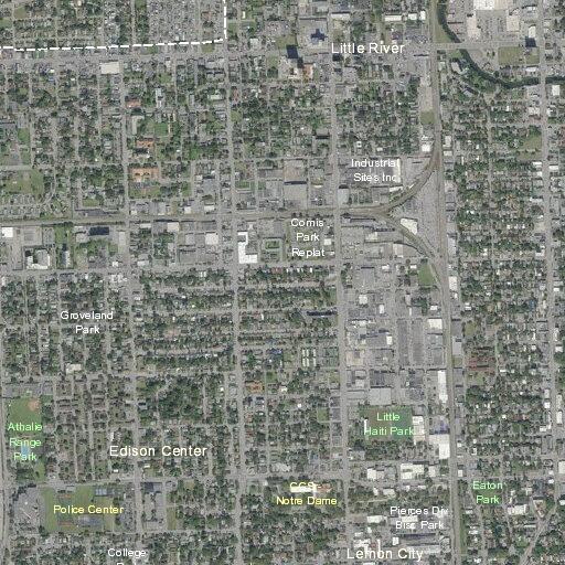 66-year-old woman with abdominal pain in Miami