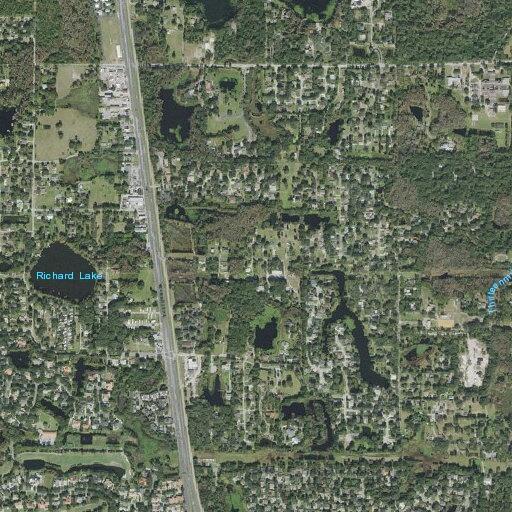 Person with diabetic problem at mobile home park