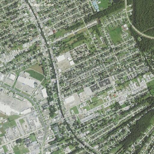 Woman hospitalized for ruptured stomach scar tissue in Houma