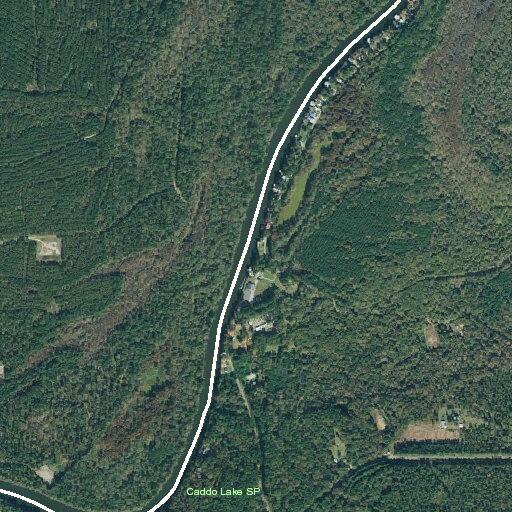 62-year-old man faints with left arm pain at lodge