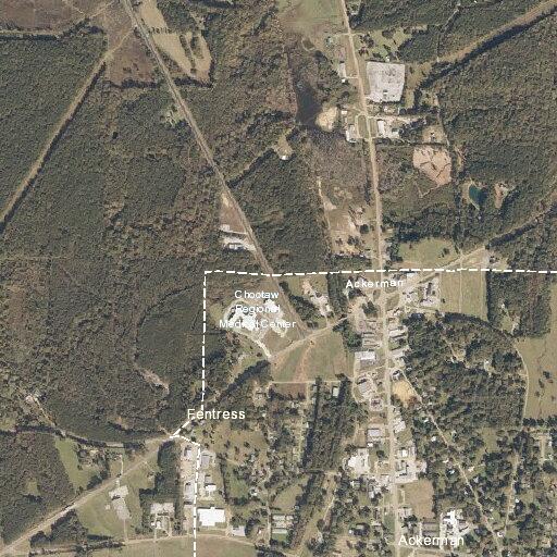 Interfacility medical transport requested in Ackerman