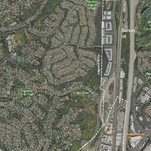 Fall patient at Watermark Senior Living in Laguna Niguel