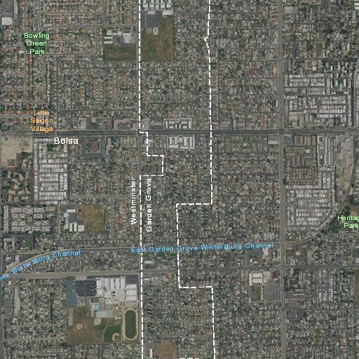 Person experiencing respiratory distress in Santa Ana
