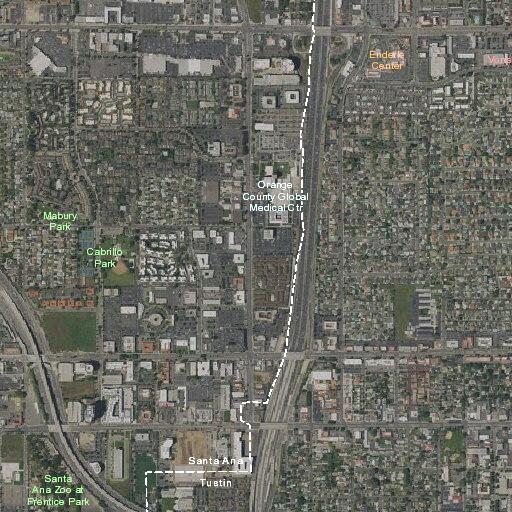 Person with cardiac complications near e 1st street