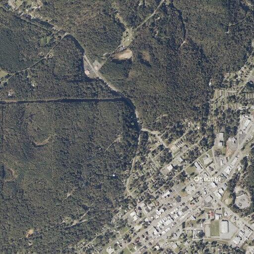 68-year-old man with severe abdominal pain in Oneonta