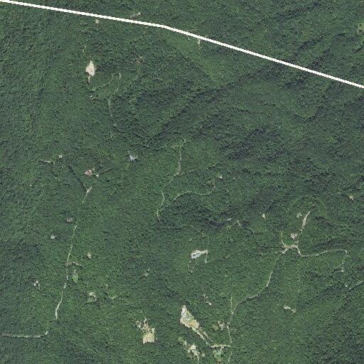 Person suffering possible kidney stone at Black Mountain