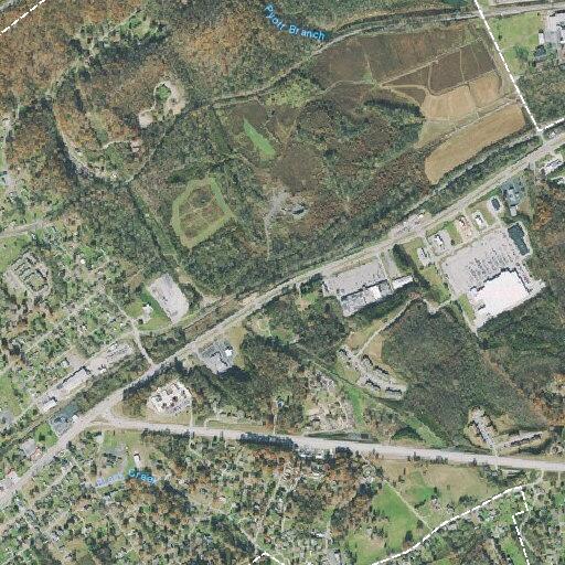 Post-operative bleeding in 71-year-old woman at Roane State Hwy