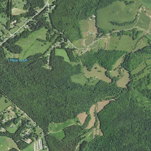 67-year-old female suspected stroke with numb arm