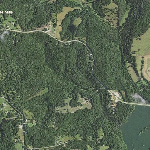 75-year-old woman with heart problems in Kissee Mills