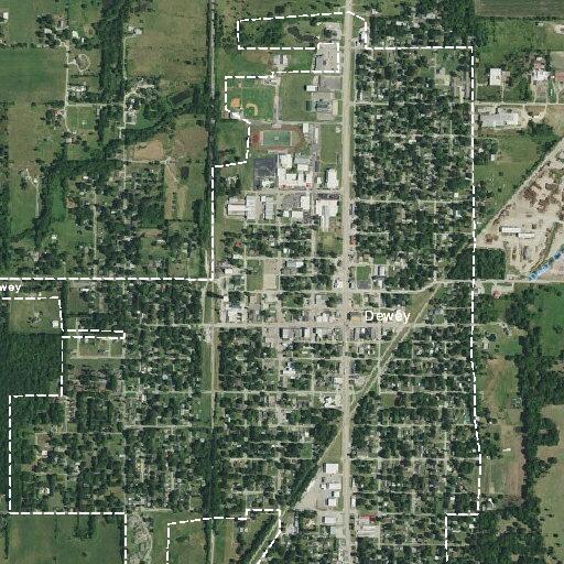 Female in 50s with kidney stones and infection near Dewey
