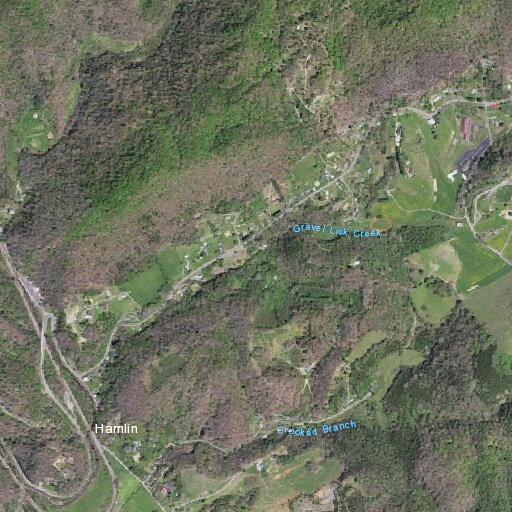 59-year-old male with post-surgery drain issues in Castlewood