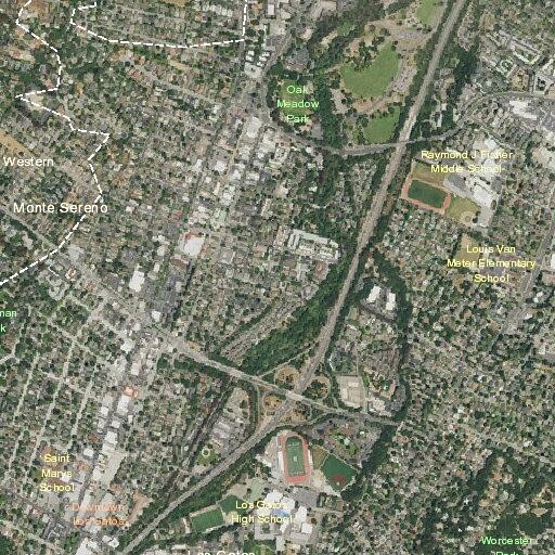 18-year-old female experiencing a seizure in Los Gatos