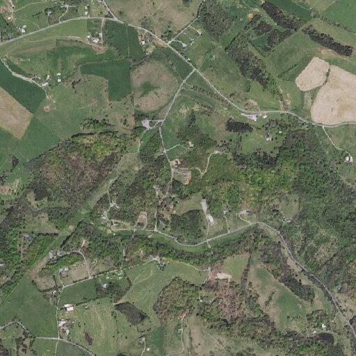 76-year-old woman falls with possible neck fractures