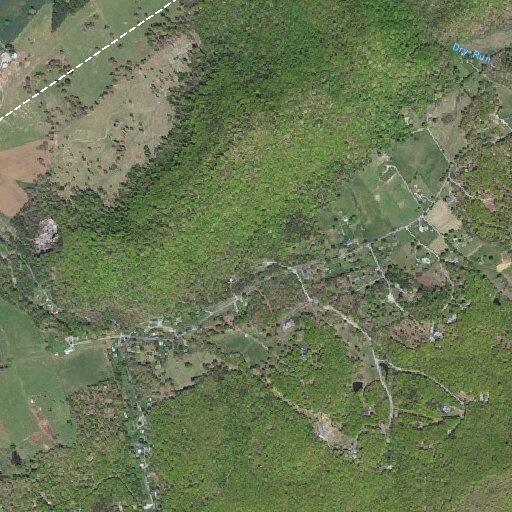 81-year-old male with rectal bleeding at Pico Rd