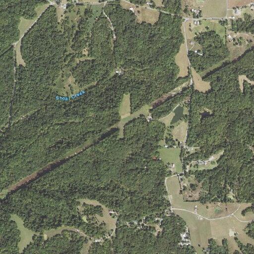 74-year-old woman falls, injures wrist, hip, and head
