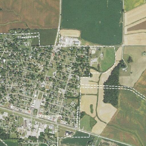 Young male post-surgery with drain in Shawneetown