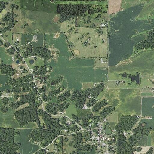 62-year-old woman has chest pains in Renault, IL
