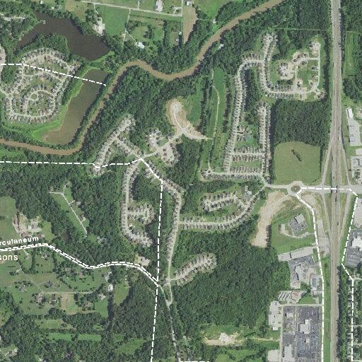 Person with abdominal pain near French Drive in Herculaneum