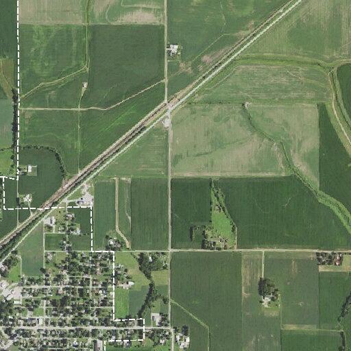 61-year-old woman with intestinal blockage in Nokomis