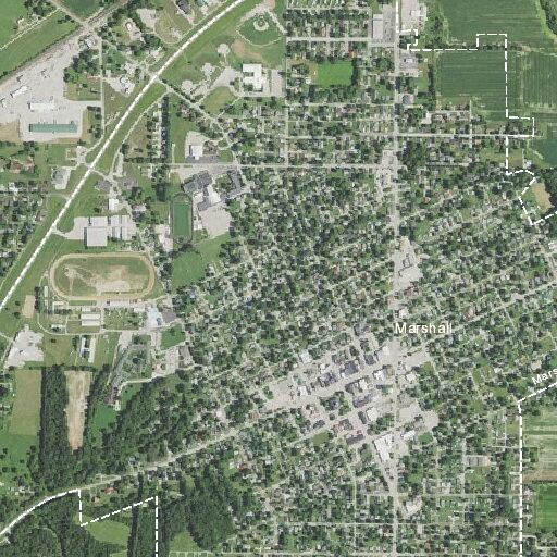 Woman with partial bowel obstruction treated in Marshall