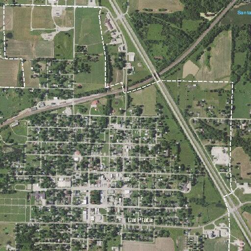 75-year-old man has heart pain after surgery in La Plata