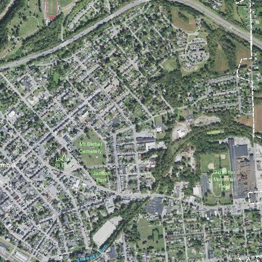 Ventilator-dependent woman experiencing pain at residence