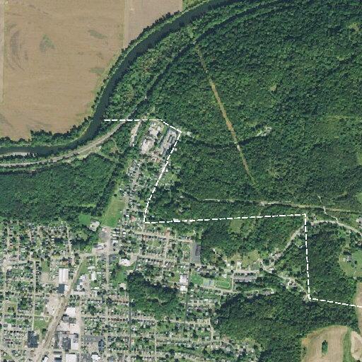 79-year-old man fell with possible broken hip