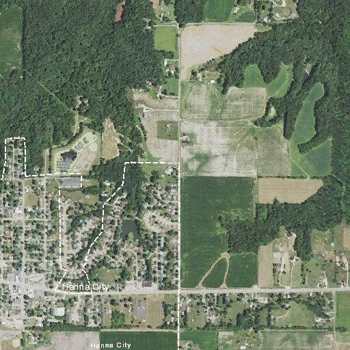 60-year-old woman with chest pain in Hanna City