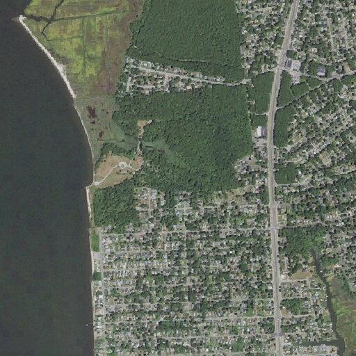 49-year-old woman with ankle swelling at Lombardy Dr and Pinetree Dr