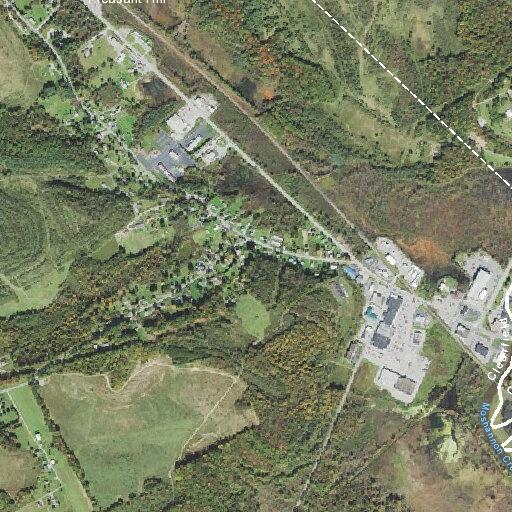 65-year-old woman near syncope with breathing issues