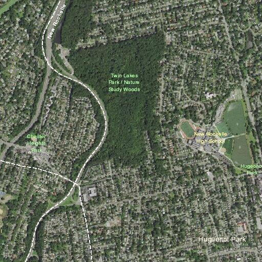 Woman reports abdominal pain near Parkview Drive, Eastchester