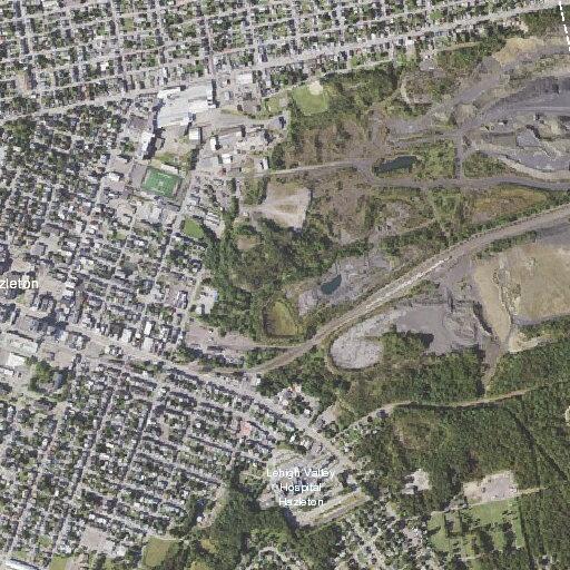 56-year-old female having shortness of breath in Hazleton