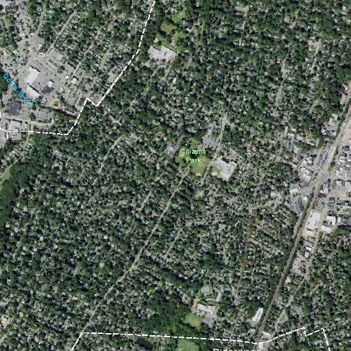 81-year-old man with possible stroke and breathing issues