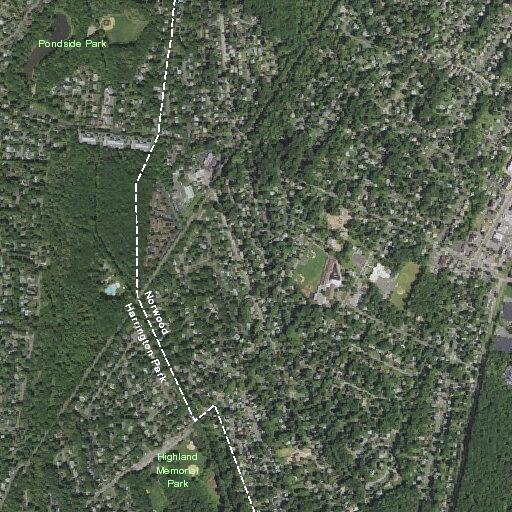 67-year-old woman slips and injures left elbow in fall