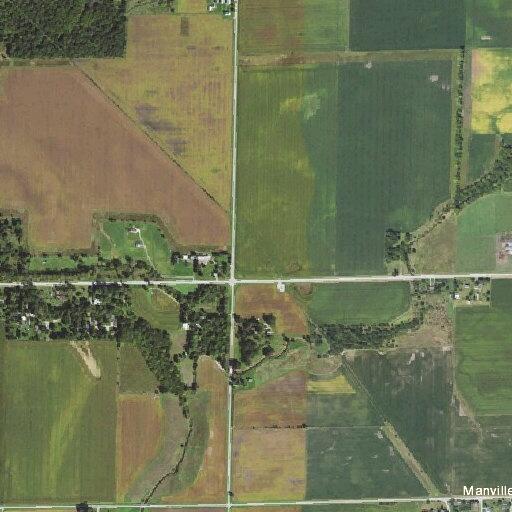 71-year-old male with chest pain after bypass surgery