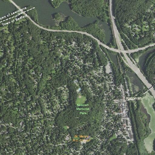 71-year-old male cancer patient having seizure in Katonah