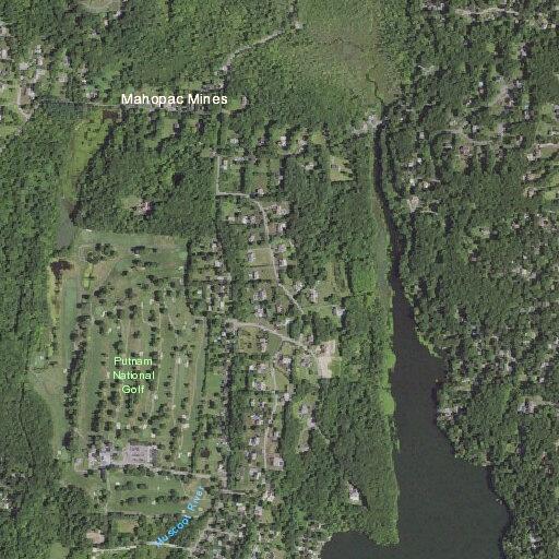 56-year-old woman with right-side numbness in Mahopac