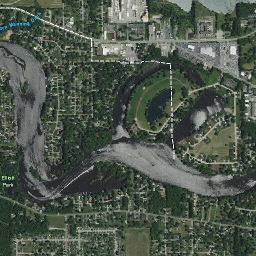 74-year-old man with chest pain in Elkhart