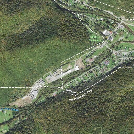 75-year-old male with chest symptoms in Galeton