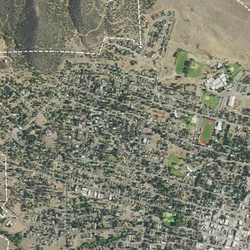 Woman with kidney stone near West Miner Street, Yreka