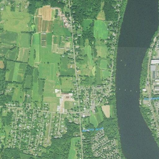 76-year-old man with chest pain in Suffield