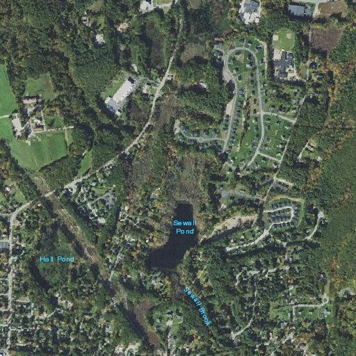 63-year-old woman with lower GI blockage at Heritage Lane