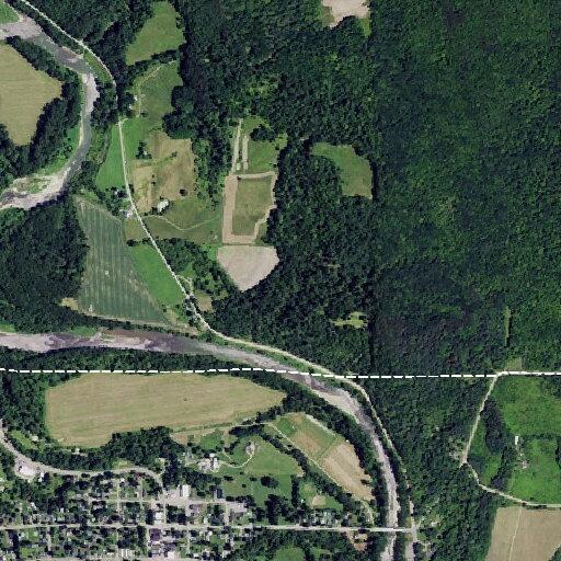 Woman with kidney stone back pain treated in Belfast
