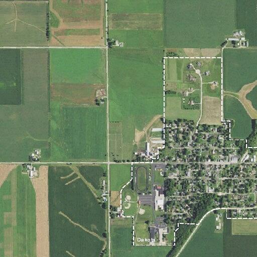 Teen female with chest pain after surgery in Dakota