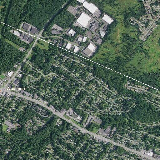 Child with leaking spinal fusion incision reported near Shepherd Ave