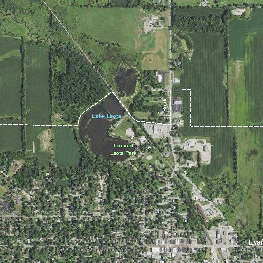 Woman with chest pain at Evansville Manor nursing home