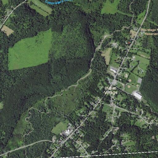Four-year-old boy struck in face during lacrosse incident