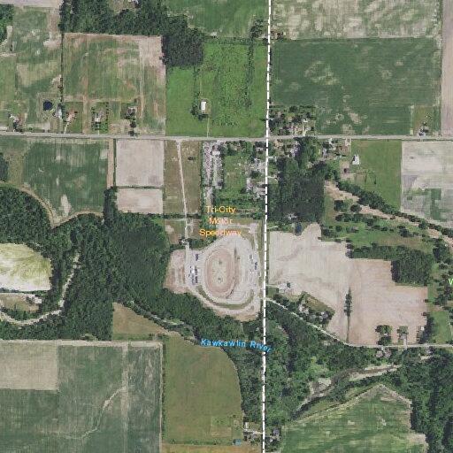 65-year-old man with chest pain at raceway entrance
